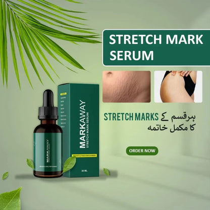 Markaway Stretch Mark Serum 30ml | Herbal Formula for Scars & Skin Elasticity NB Collection Shop